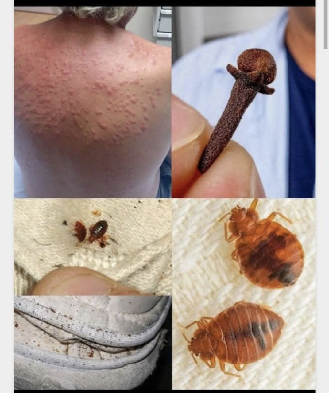 ⚠️ BE CAREFUL, If you spot these dots on your skin, it means you have Ca…see more