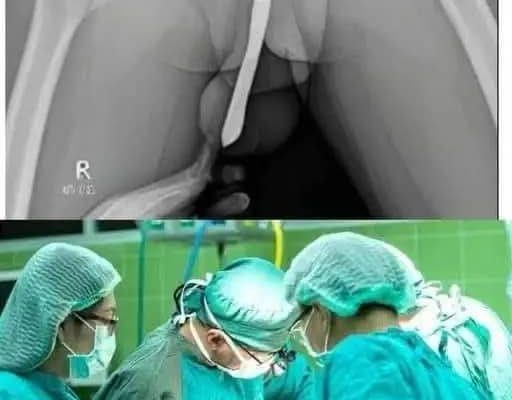 Doctors are speechless: Just boil these 2 ingredients and you will quickly lose your body fat